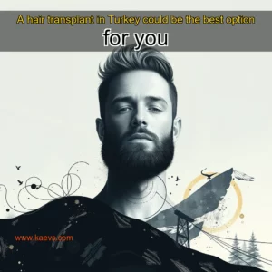 Artistic representation for A hair transplant in Turkey could be the best option for you