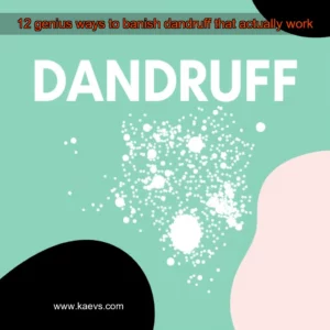 Artistic representation for 12 genius ways to banish dandruff that actually work